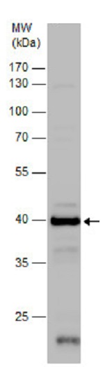 Western blot - Anti-Citrate synthetase antibody (ab96600), expandable thumbnail