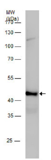 Western blot - Anti-Citrate synthetase antibody (AB96600), expandable thumbnail