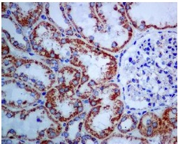Immunohistochemistry (Formalin/PFA-fixed paraffin-embedded sections) - Anti-Citrate synthetase antibody [EPR8066] (AB129088)