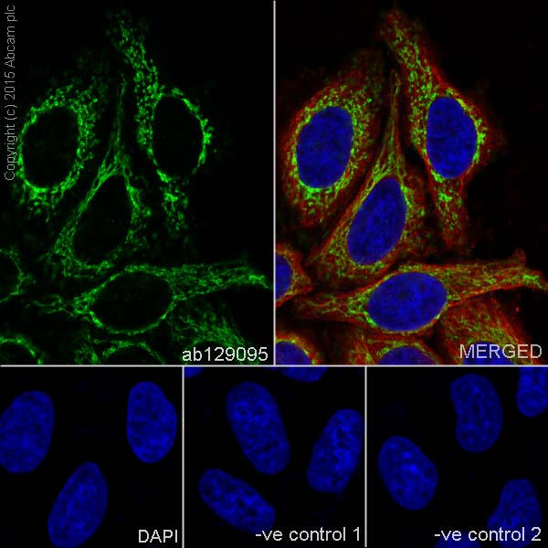 アレルギー Anti-Citrate synthetase antibody [EPR8067] 20 ul size