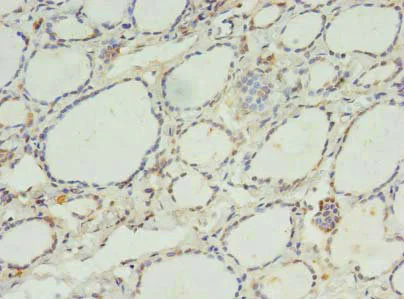 Immunohistochemistry (Formalin/PFA-fixed paraffin-embedded sections) - Anti-CK068 antibody (AB235318)