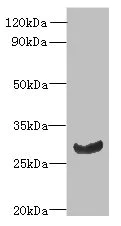 Western blot - Anti-CK068 antibody (AB235318)