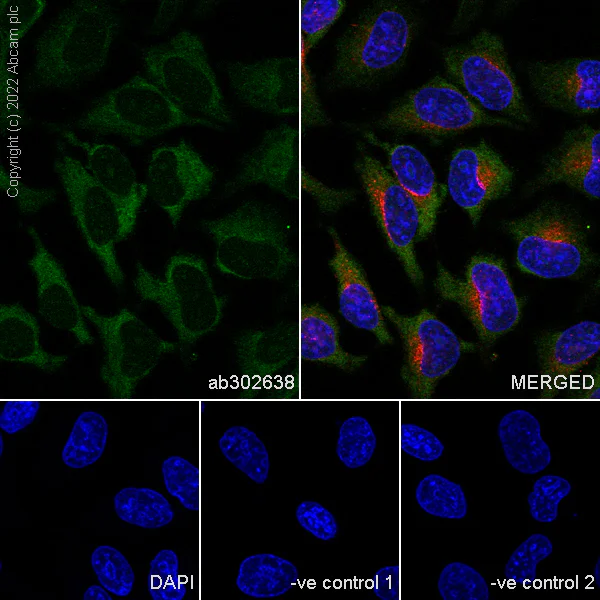 Immunocytochemistry/ Immunofluorescence - Anti-CK1 epsilon antibody [1/Casein Kinase Iε] (AB302638)