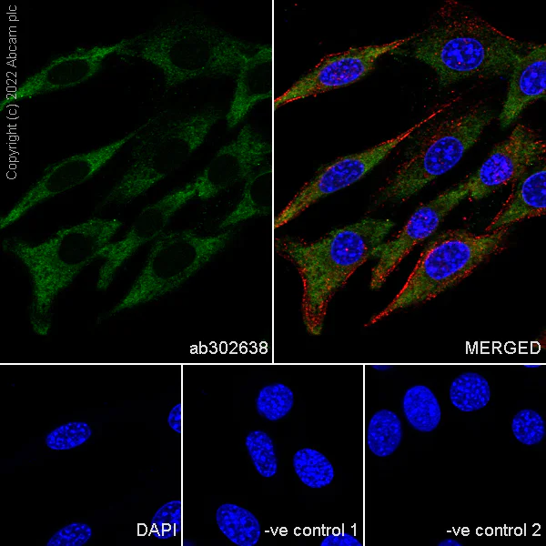 Immunocytochemistry/ Immunofluorescence - Anti-CK1 epsilon antibody [1/Casein Kinase Iε] (AB302638)