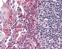 Immunohistochemistry (Formalin/PFA-fixed paraffin-embedded sections) - Anti-CK1 epsilon antibody (AB115293)