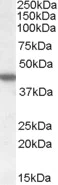 Western blot - Anti-CK1 epsilon antibody (AB115293)