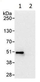 Immunoprecipitation - Anti-CK1 epsilon antibody (AB264277)