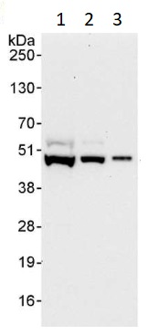 Western blot - Anti-CK1 epsilon antibody (AB264277)
