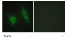 Immunocytochemistry/ Immunofluorescence - Anti-CK1 epsilon antibody (AB70110)
