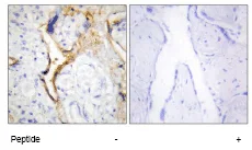 Immunohistochemistry (Formalin/PFA-fixed paraffin-embedded sections) - Anti-CK1 epsilon antibody (AB70110)