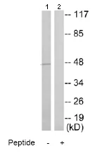 Western blot - Anti-CK1 epsilon antibody (AB70110)