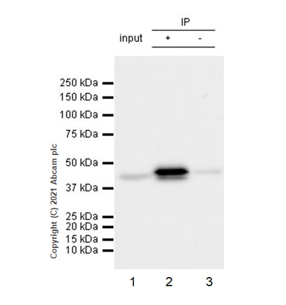 Immunoprecipitation - Anti-CK1 epsilon antibody [EPR24332-25] (AB270997)