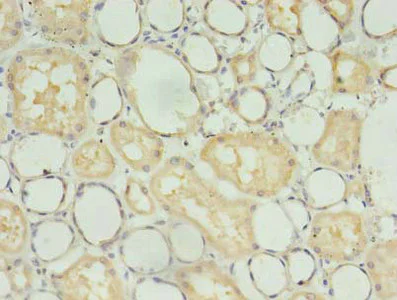 Immunohistochemistry (Formalin/PFA-fixed paraffin-embedded sections) - Anti-CKAP1/TBCB antibody (AB237483)