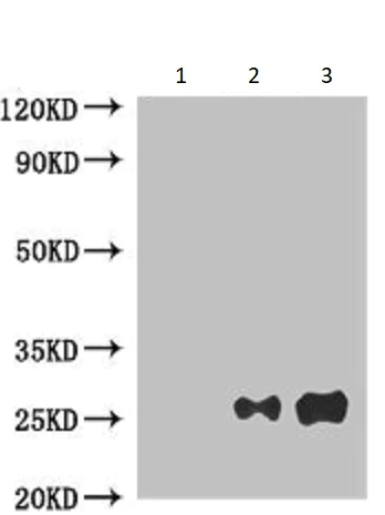 Immunoprecipitation - Anti-CKAP1/TBCB antibody (AB237483)