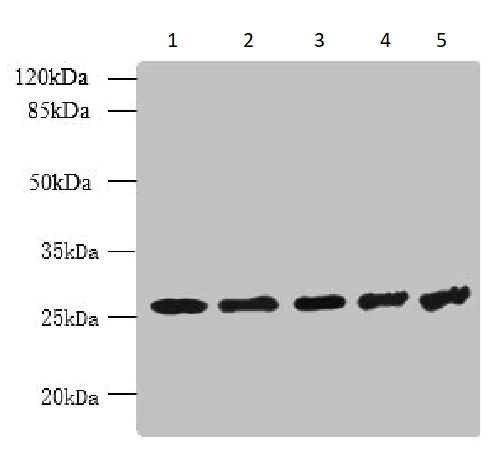Western blot - Anti-CKAP1/TBCB antibody (AB237483)