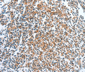 Immunohistochemistry (Formalin/PFA-fixed paraffin-embedded sections) - Anti-CKAP2/LB1 antibody (AB198188), expandable thumbnail