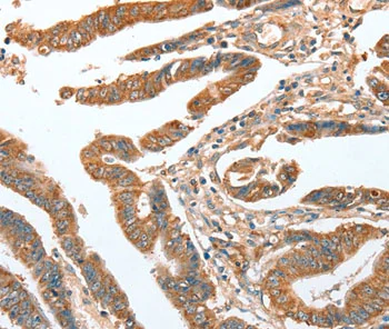 Immunohistochemistry (Formalin/PFA-fixed paraffin-embedded sections) - Anti-CKAP2/LB1 antibody (AB198188)