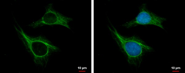 Immunocytochemistry/ Immunofluorescence - Anti-CKAP2/LB1 antibody (AB227214)