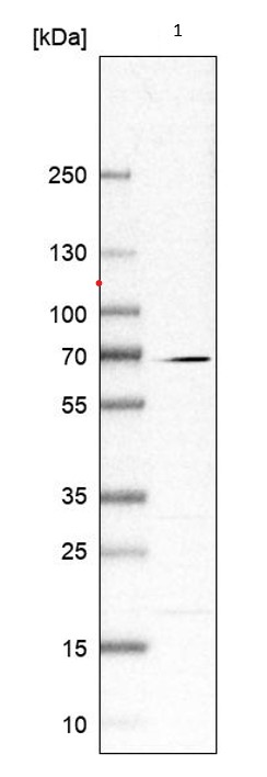 Western blot - Anti-CKAP2L antibody (AB221897), expandable thumbnail