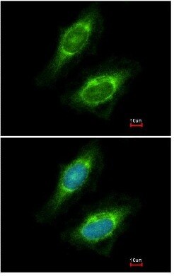 Immunocytochemistry/ Immunofluorescence - Anti-CKAP4 antibody (AB152154), expandable thumbnail