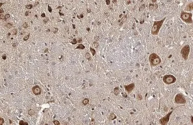 Immunohistochemistry (Formalin/PFA-fixed paraffin-embedded sections) - Anti-CKAP4 antibody (AB152154)