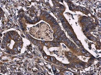 Immunohistochemistry (Formalin/PFA-fixed paraffin-embedded sections) - Anti-CKAP4 antibody (AB152154)