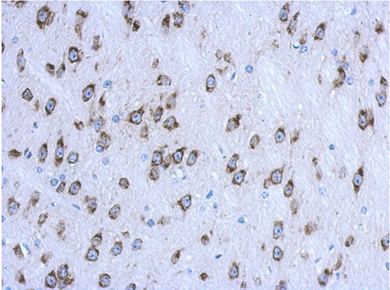Immunohistochemistry (Formalin/PFA-fixed paraffin-embedded sections) - Anti-CKAP4 antibody (AB152154), expandable thumbnail