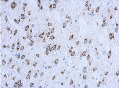 Immunohistochemistry (Formalin/PFA-fixed paraffin-embedded sections) - Anti-CKAP4 antibody (AB152154)