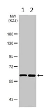 Western blot - Anti-CKAP4 antibody (AB152154)