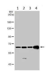 Western blot - Anti-CKAP4 antibody (AB152154)