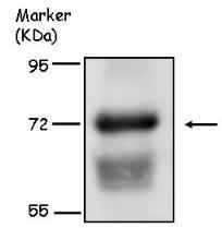 Western blot - Anti-CKAP4 antibody (AB152154), expandable thumbnail