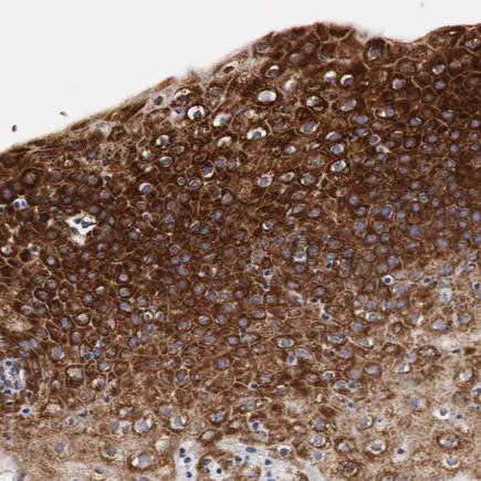 Immunohistochemistry (Formalin/PFA-fixed paraffin-embedded sections) - Anti-CKAP4 antibody (AB223774)