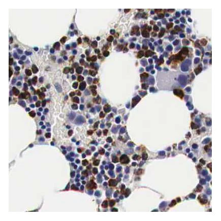 Immunohistochemistry (Formalin/PFA-fixed paraffin-embedded sections) - Anti-CKAP4 antibody (AB223774)