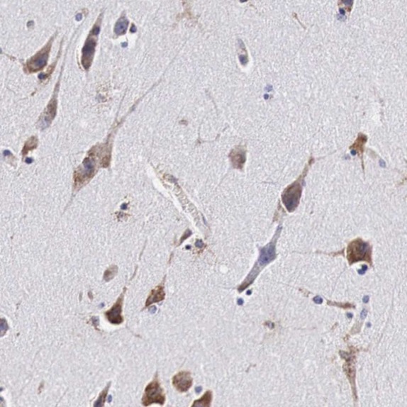 Immunohistochemistry (Formalin/PFA-fixed paraffin-embedded sections) - Anti-CKAP4 antibody (AB223774)