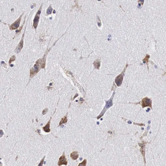 Immunohistochemistry (Formalin/PFA-fixed paraffin-embedded sections) - Anti-CKAP4 antibody (AB223774)