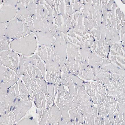 Immunohistochemistry (Formalin/PFA-fixed paraffin-embedded sections) - Anti-CKAP4 antibody (AB223774)