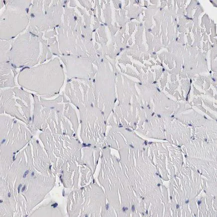 Immunohistochemistry (Formalin/PFA-fixed paraffin-embedded sections) - Anti-CKAP4 antibody (AB223774)