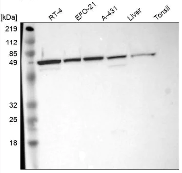 Western blot - Anti-CKAP4 antibody (AB223774)
