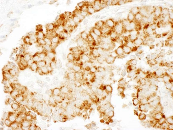 Immunohistochemistry (Formalin/PFA-fixed paraffin-embedded sections) - Anti-CKAP4 antibody (AB245507)