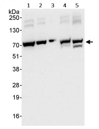 Western blot - Anti-CKAP4 antibody (AB245507)