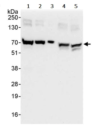Western blot - Anti-CKAP4 antibody (AB245508)