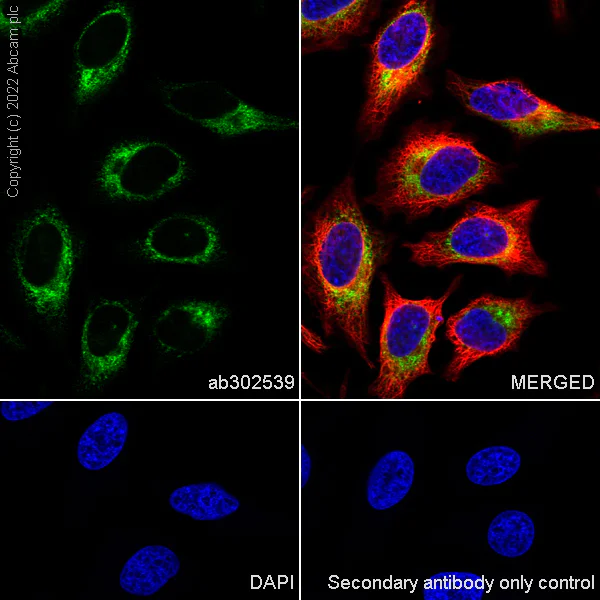 Immunocytochemistry/ Immunofluorescence - Anti-CKAP4 antibody [EPR25713-62] (AB302539)