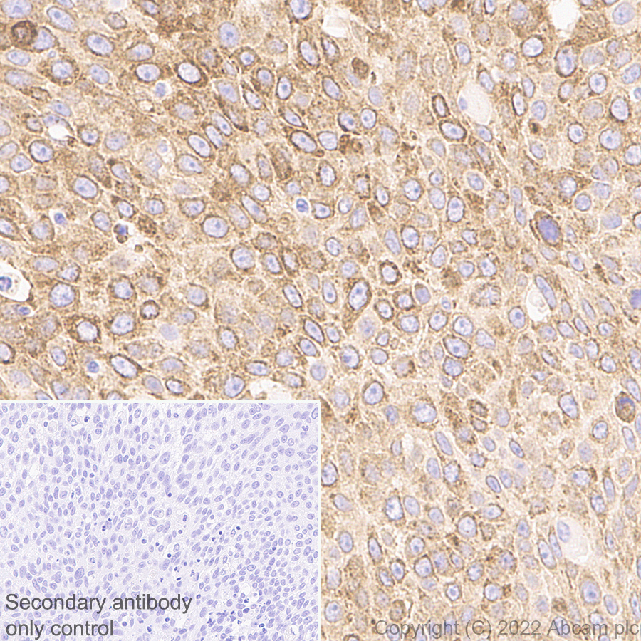 Immunohistochemistry (Formalin/PFA-fixed paraffin-embedded sections) - Anti-CKAP4 antibody [EPR25713-62] (AB302539)