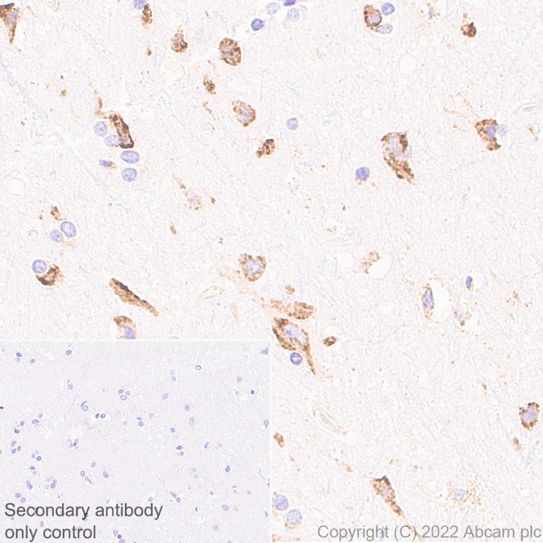 Immunohistochemistry (Formalin/PFA-fixed paraffin-embedded sections) - Anti-CKAP4 antibody [EPR25713-62] (BSA and Azide free) (AB302540)
