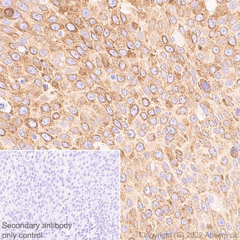 Immunohistochemistry (Formalin/PFA-fixed paraffin-embedded sections) - Anti-CKAP4 antibody [EPR25713-62] (BSA and Azide free) (AB302540)