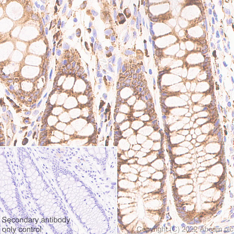 Immunohistochemistry (Formalin/PFA-fixed paraffin-embedded sections) - Anti-CKAP4 antibody [EPR25713-62] (BSA and Azide free) (AB302540)