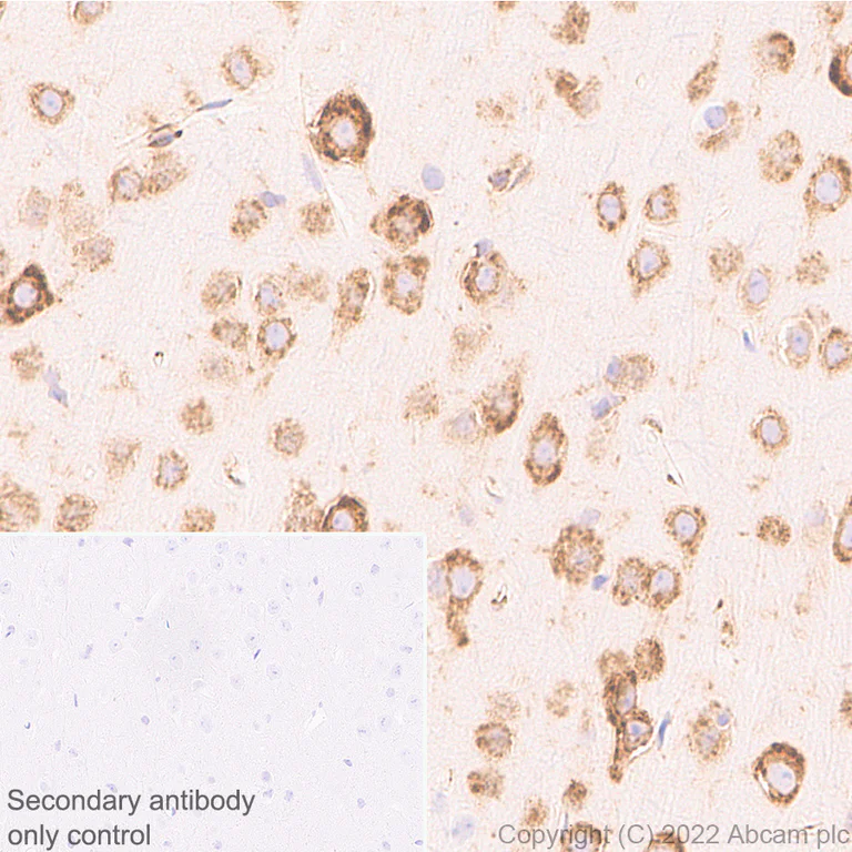Immunohistochemistry (Formalin/PFA-fixed paraffin-embedded sections) - Anti-CKAP4 antibody [EPR25713-62] (BSA and Azide free) (AB302540)