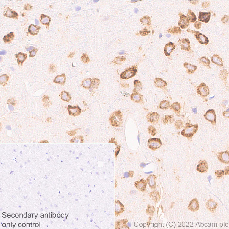 Immunohistochemistry (Formalin/PFA-fixed paraffin-embedded sections) - Anti-CKAP4 antibody [EPR25713-62] (BSA and Azide free) (AB302540)