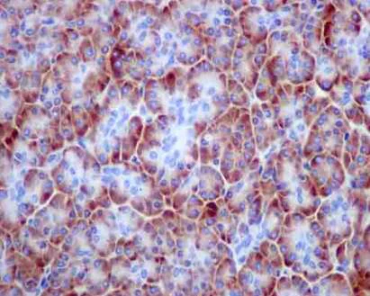 Immunohistochemistry (Formalin/PFA-fixed paraffin-embedded sections) - Anti-CKLF antibody [EPR11985(2)] - BSA and Azide free (AB250213)