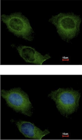 Immunocytochemistry/ Immunofluorescence - Anti-CKMT2 antibody (AB151450), expandable thumbnail